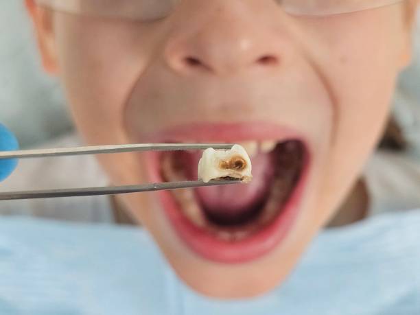Best Pediatric Emergency Dentist in Gages Lake, IL